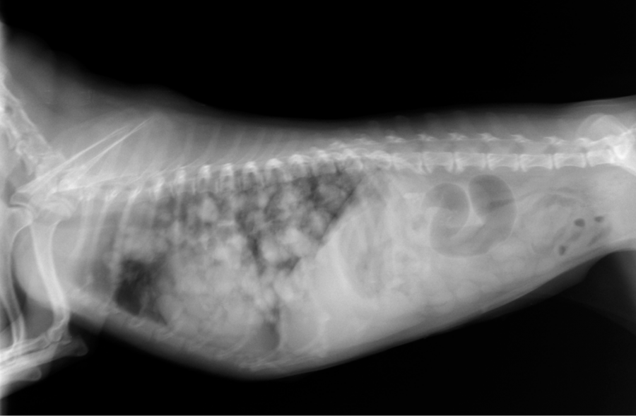 悪性乳腺腫瘍が肺転移を起こしたレントゲン写真